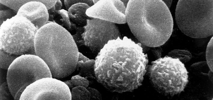 Sistema inmune (I). Leucocitos, inmunidad innata y resistencia a la infección.